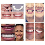 Instant Perfect Smile Upper & Lower Clip/Snap On Veneers for Perfect Teeth